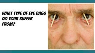 The 2 Main Types Of Under Eye Bags Here's How To deal withThem