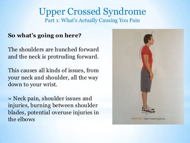 The 3 most common sources of chronic pain