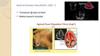 Focus Assessed Transthoracic Ultrasound ( FATE ) - 22 Nov 2024 - Dr ...