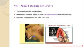 Focus Assessed Transthoracic Ultrasound ( FATE ) - 22 Nov 2024 - Dr ...