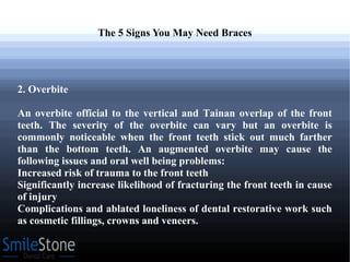 The 5 Signs You May Need Braces
2. Overbite
An overbite official to the vertical and Tainan overlap of the front
teeth. The severity of the overbite can vary but an overbite is
commonly noticeable when the front teeth stick out much farther
than the bottom teeth. An augmented overbite may cause the
following issues and oral well being problems:
Increased risk of trauma to the front teeth
Significantly increase likelihood of fracturing the front teeth in cause
of injury
Complications and ablated loneliness of dental restorative work such
as cosmetic fillings, crowns and veneers.
 