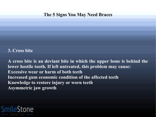 The 5 Signs You May Need Braces
3. Cross bite
A cross bite is an deviant bite in which the upper bone is behind the
lower hostile tooth. If left untreated, this problem may cause:
Excessive wear or harm of both teeth
Increased gum economic condition of the affected teeth
Knowledge to restore injury or worn teeth
Asymmetric jaw growth
 