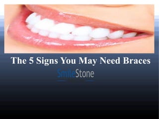 The 5 Signs You May Need Braces
 