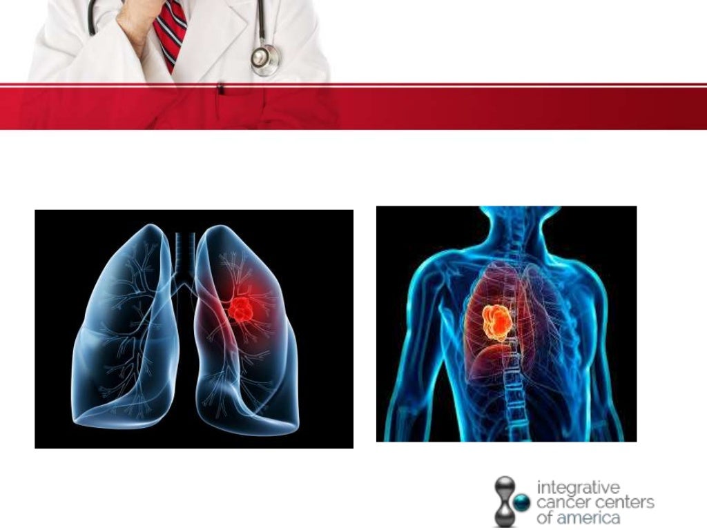 The 6 most deadly forms of lung cancer