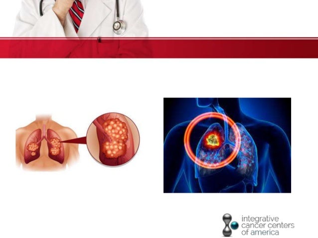 How deadly is lung cancer