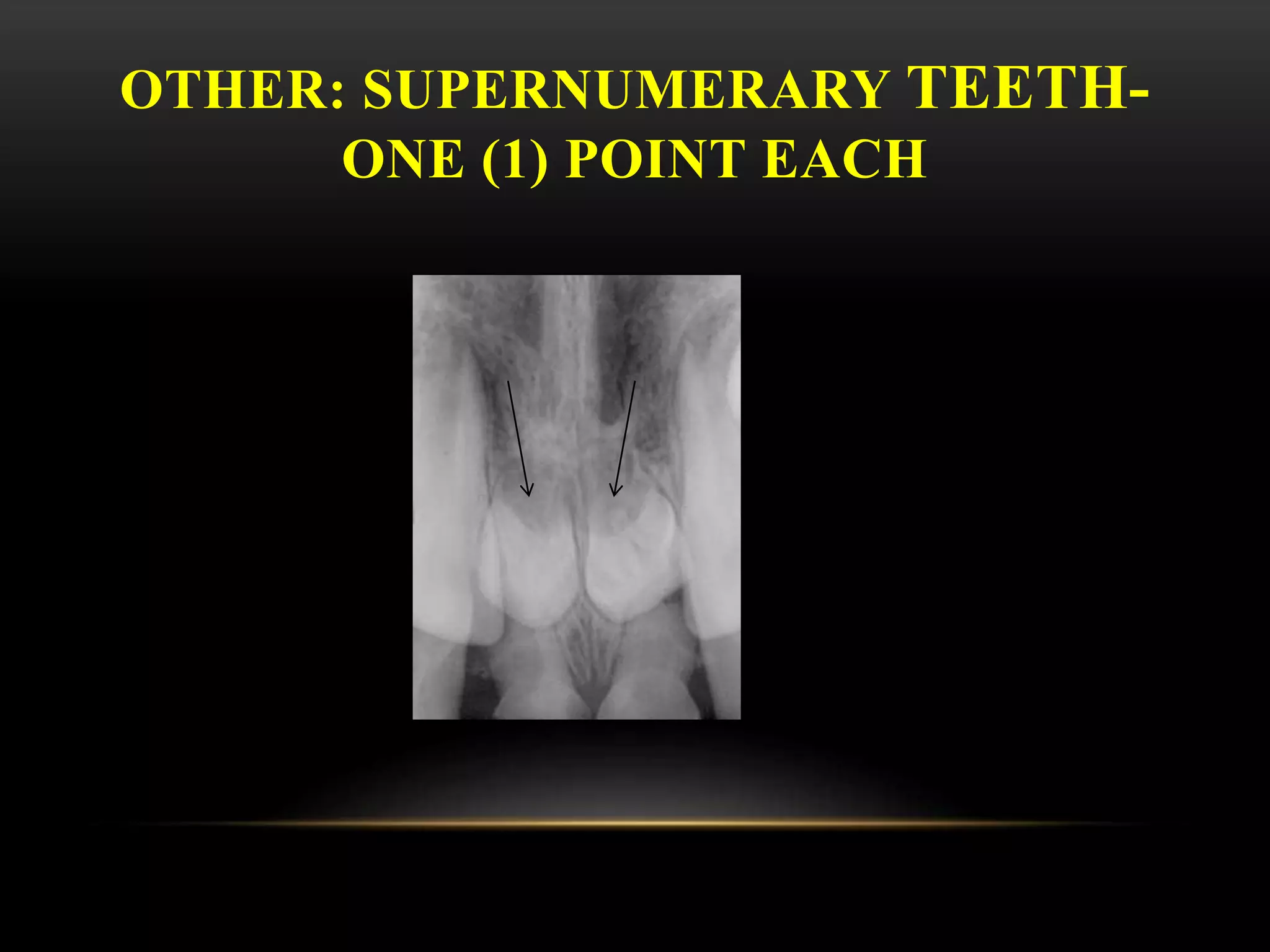 OTHER: SUPERNUMERARY TEETH-
ONE (1) POINT EACH
 