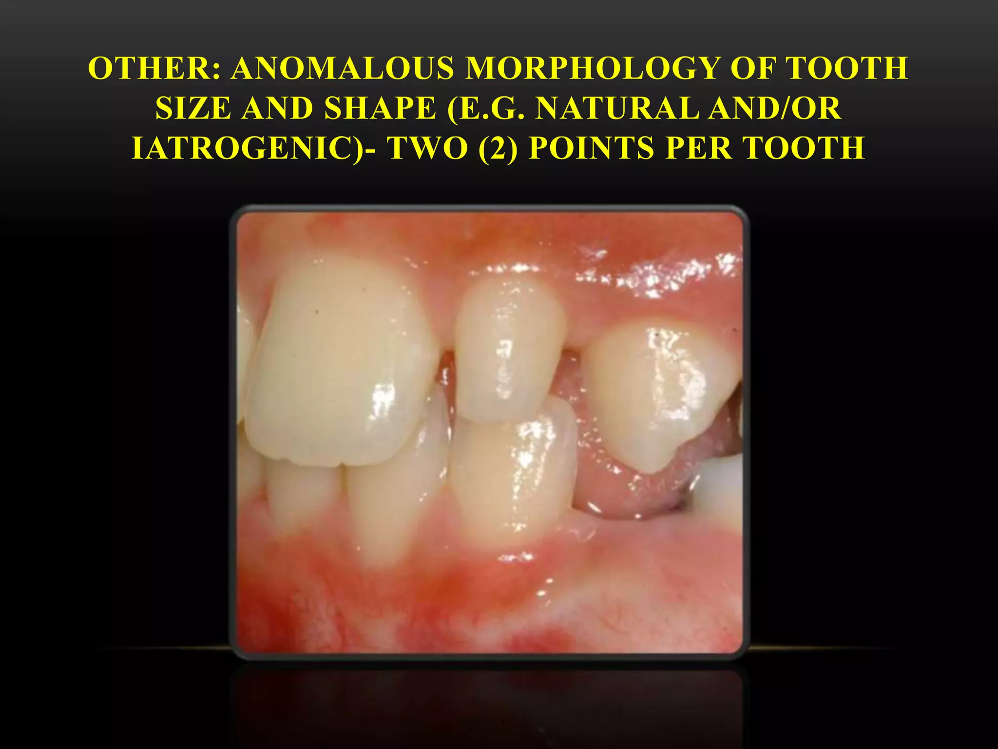 OTHER: ANOMALOUS MORPHOLOGY OF TOOTH
SIZE AND SHAPE (E.G. NATURAL AND/OR
IATROGENIC)- TWO (2) POINTS PER TOOTH
 