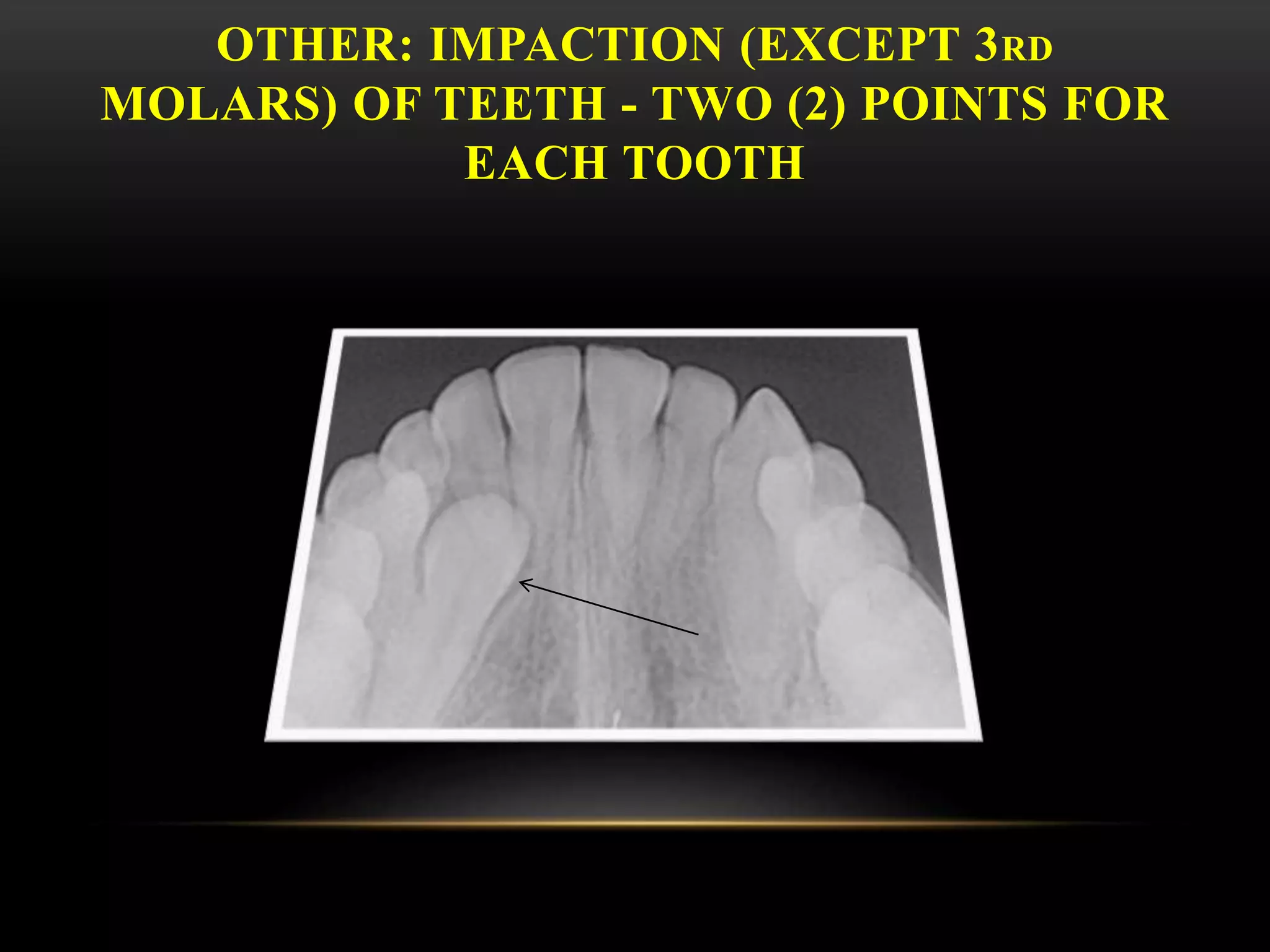 OTHER: IMPACTION (EXCEPT 3RD
MOLARS) OF TEETH - TWO (2) POINTS FOR
EACH TOOTH
 