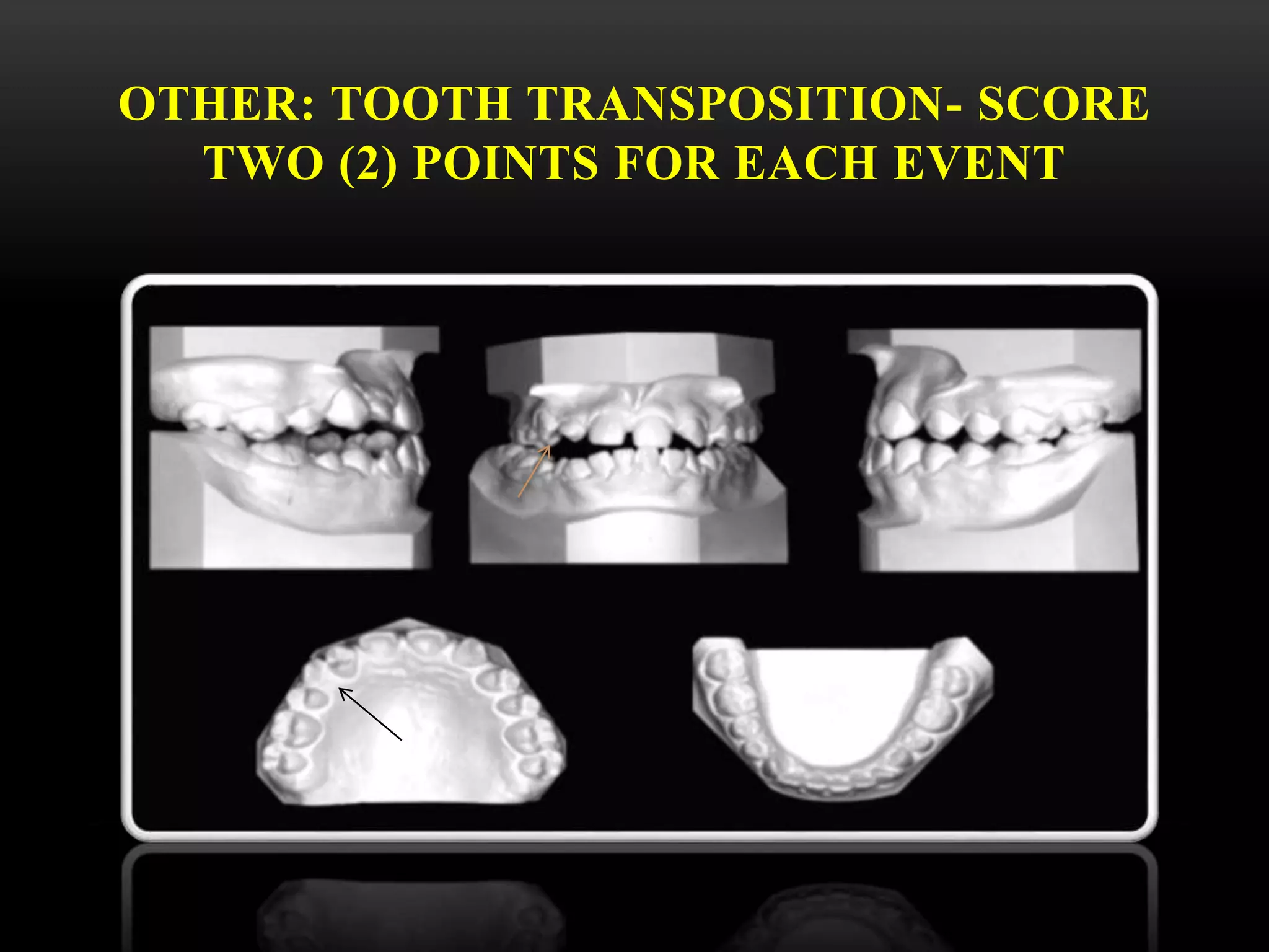 OTHER: TOOTH TRANSPOSITION- SCORE
TWO (2) POINTS FOR EACH EVENT
 