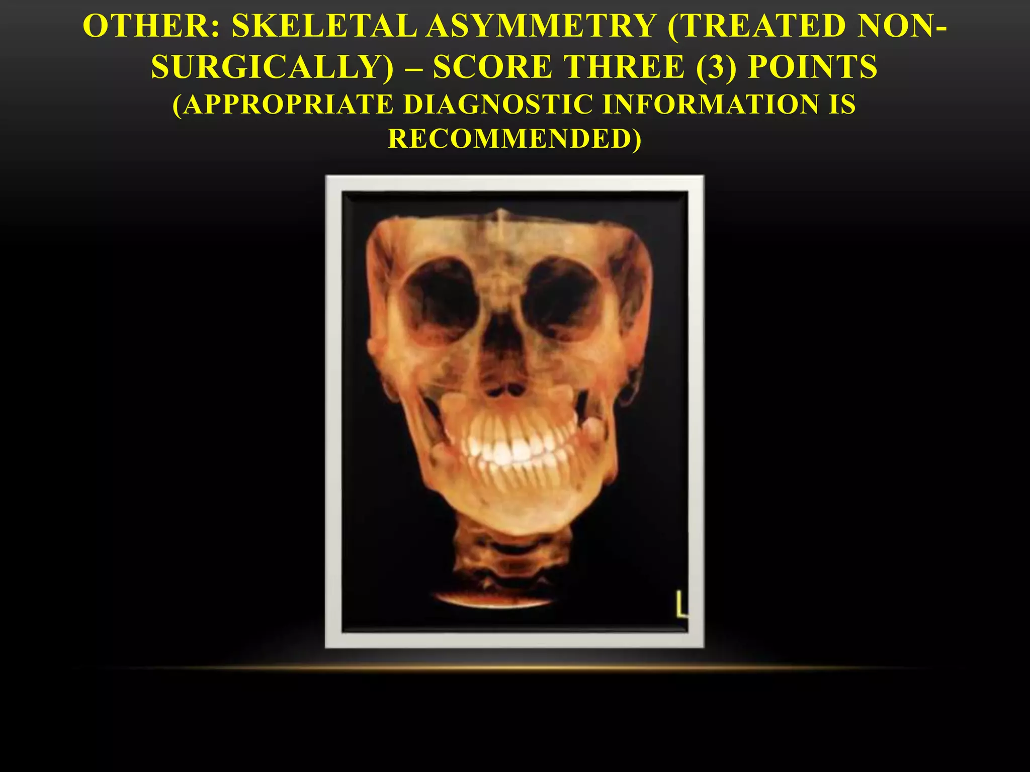 OTHER: SKELETAL ASYMMETRY (TREATED NON-
SURGICALLY) – SCORE THREE (3) POINTS
(APPROPRIATE DIAGNOSTIC INFORMATION IS
RECOMMENDED)
 