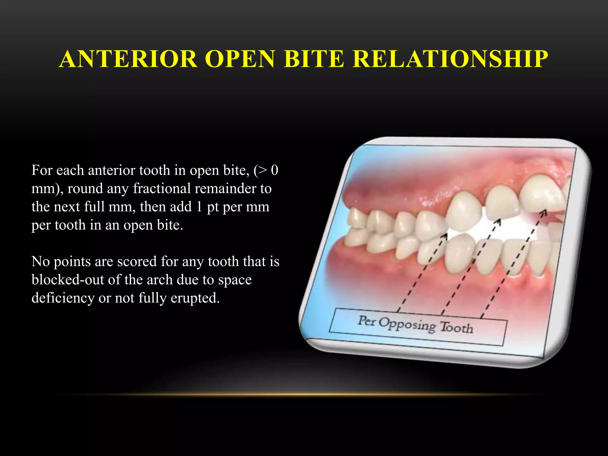 ANTERIOR OPEN BITE RELATIONSHIP
For each anterior tooth in open bite, (> 0
mm), round any fractional remainder to
the next full mm, then add 1 pt per mm
per tooth in an open bite.
No points are scored for any tooth that is
blocked-out of the arch due to space
deficiency or not fully erupted.
 