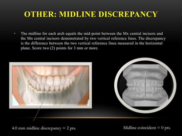 The abo discrepancy index (di) | PPTX | Dental Health | Diseases and ...