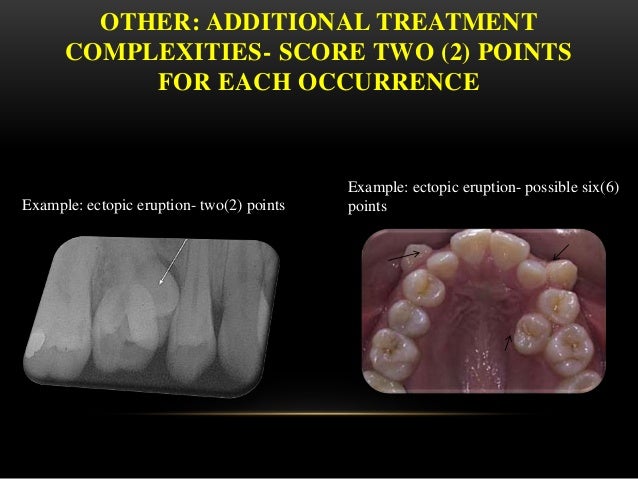 The abo discrepancy index (di)