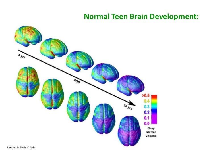 The Heart Of Matter Adolescent Brain >> The Adolescent Brain Some Implication For Educators C The Heart Of Matter Adolescent Brain >> The Adolescent Brain Some Implication For Educators C