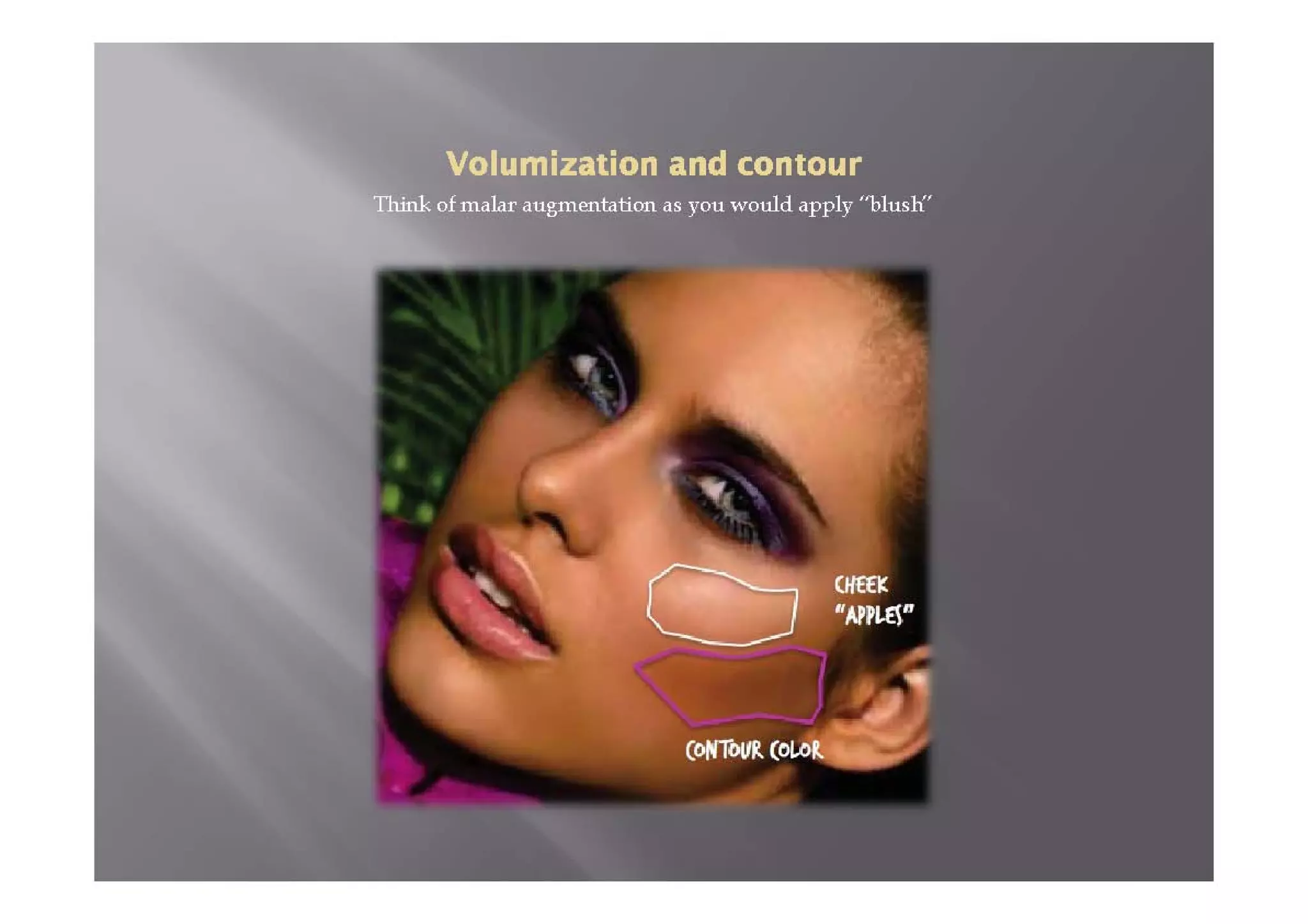 Augmentation 36 The Aesthetic Benefits of Malar Augmentation | PDF