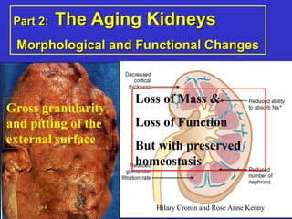Part 2: The Aging Kidneys 
Morphological and Functional Changes 
Hilary Cronin and Rose Anne Kenny 
Gross granularity 
and pitting of the 
external surface 
Loss of Mass & 
Loss of Function 
But with preserved 
homeostasis 
 