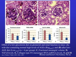 Effect of a low-glycotoxin diet on glomeruli and renal function in mice: (A) 
with diet containing normal high levels of AGEs (RegAGE), and (B) after low- 
AGE diet (LowAGE) (n = 6 per group). C, Fractional mesangial volume. D, 
TGF-β levels. E, Collagen type IV) messenger RNA (mRNA) levels. F, uACR 
Am J Pathol 170[6]:1893-1902, 2007. Brenner and Rector's The Kidney, 9th ed. 
 
