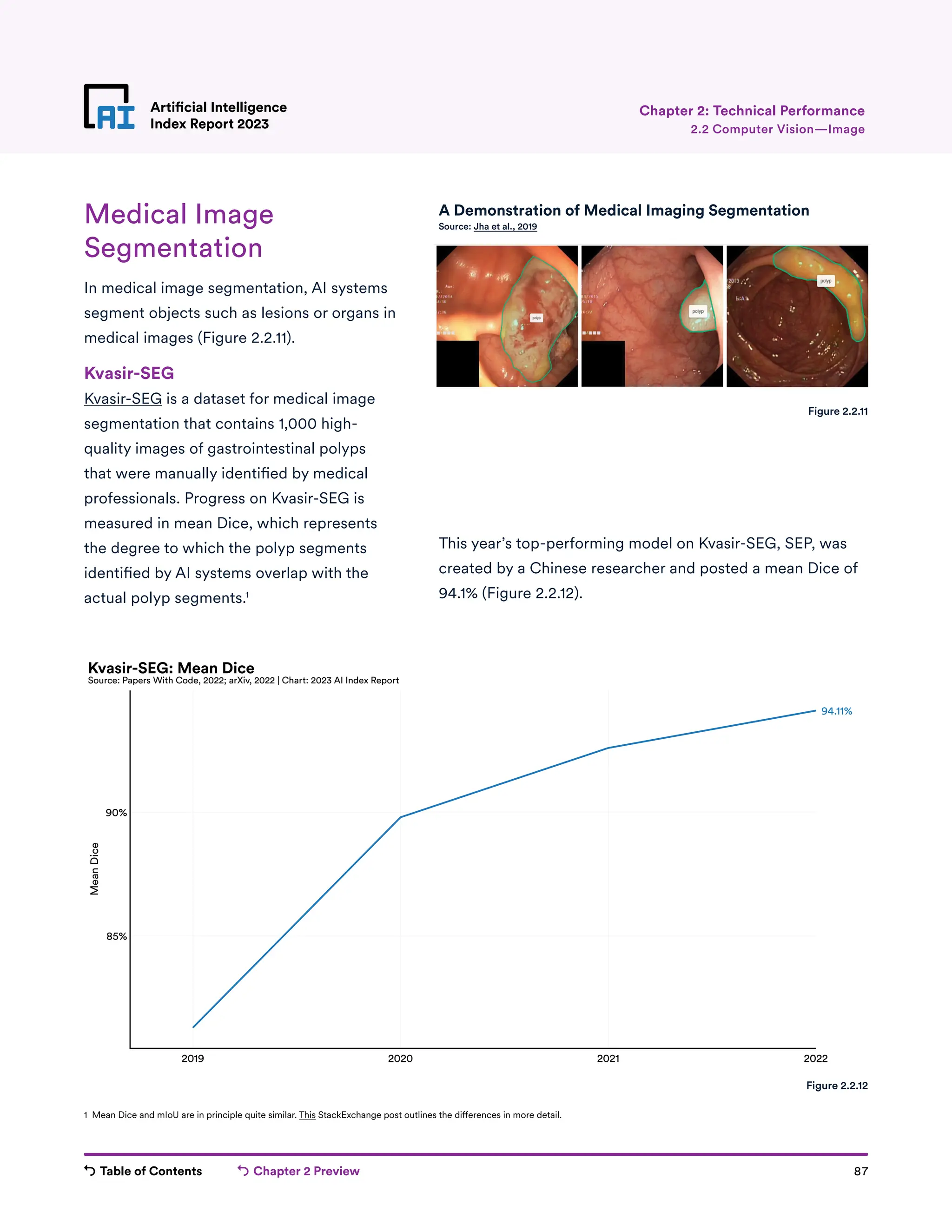 Table of Contents Chapter 2 Preview 87
Artificial Intelligence
Index Report 2023
Artificial Intelligence
Index Report 2023 2.2 Computer Vision—Image
Chapter 2: Technical Performance
Medical Image
Segmentation
In medical image segmentation, AI systems
segment objects such as lesions or organs in
medical images (Figure 2.2.11).
Kvasir-SEG
Kvasir-SEG is a dataset for medical image
segmentation that contains 1,000 high-
quality images of gastrointestinal polyps
that were manually identified by medical
professionals. Progress on Kvasir-SEG is
measured in mean Dice, which represents
the degree to which the polyp segments
identified by AI systems overlap with the
actual polyp segments.1
This year’s top-performing model on Kvasir-SEG, SEP, was
created by a Chinese researcher and posted a mean Dice of
94.1% (Figure 2.2.12).
Figure 2.2.11
2019 2020 2021 2022
85%
90%
Mean
Dice
94.11%
Kvasir-SEG: Mean Dice
Source: Papers With Code, 2022; arXiv, 2022 | Chart: 2023 AI Index Report
Figure 2.2.12
1 Mean Dice and mIoU are in principle quite similar. This StackExchange post outlines the differences in more detail.
A Demonstration of Medical Imaging Segmentation
Source: Jha et al., 2019
 