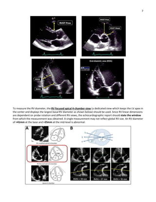 Cardioserve Rv Focused View THE AMERICAN SOCIETY OF ECHOCARDIOGRAPHY RECOMMENDATIONS FOR.pdf