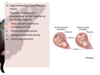 Amniotic fluid will turn Nitrazine paper blue because of the alkaline pH