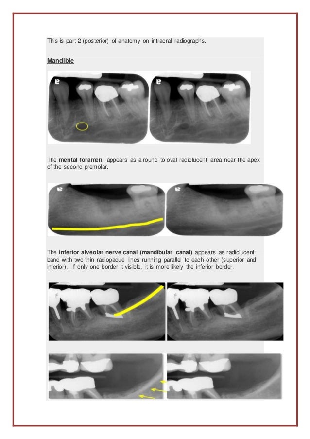 The anterior portion of intraoral radiographs