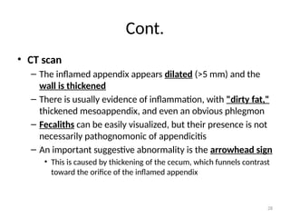 Appendix:- anatomy, physiology & disease | PPTX