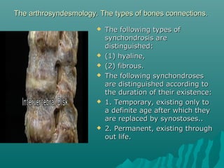 The arthrosyndesmology. The types ooff bboonneess ccoonnnneeccttiioonnss.. 
 TThhee ffoolllloowwiinngg ttyyppeess ooff 
ssyynncchhoonnddrroossiiss aarree 
ddiissttiinngguuiisshheedd:: 
 ((11)) hhyyaalliinnee,, 
 ((22)) ffiibbrroouuss.. 
 TThhee ffoolllloowwiinngg ssyynncchhoonnddrroosseess 
aarree ddiissttiinngguuiisshheedd aaccccoorrddiinngg ttoo 
tthhee dduurraattiioonn ooff tthheeiirr eexxiisstteennccee:: 
 11.. TTeemmppoorraarryy,, eexxiissttiinngg oonnllyy ttoo 
aa ddeeffiinniittee aaggee aafftteerr wwhhiicchh tthheeyy 
aarree rreeppllaacceedd bbyy ssyynnoossttoosseess.... 
 22.. PPeerrmmaanneenntt,, eexxiissttiinngg tthhrroouugghh 
oouutt lliiffee.. 
 