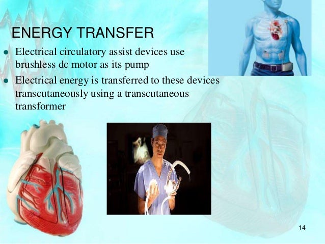 Artificial pumping of heart using transcutaneous transformer essay 07 picture