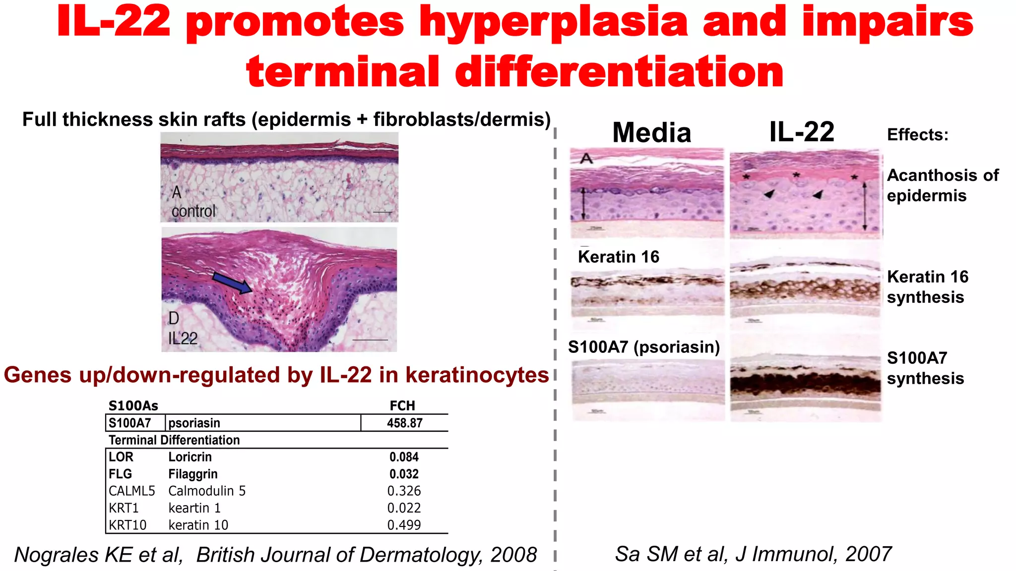The atopic dermatitis pathogenesis and implications for alopecia areata ...