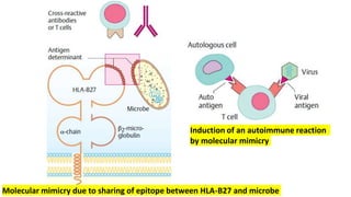 Induction of an autoimmune reaction
by molecular mimicry
Molecular mimicry due to sharing of epitope between HLA-B27 and microbe
 
