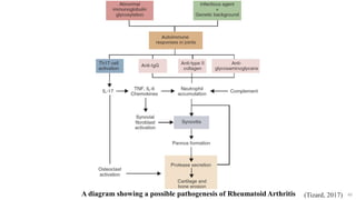 60
A diagram showing a possible pathogenesis of Rheumatoid Arthritis (Tizard, 2017)
 