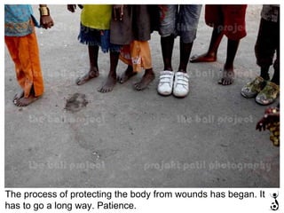 The process of protecting the body from wounds has began. It has to go a long way. Patience. 