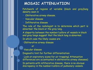 The basic interpretation of hrct | PPT