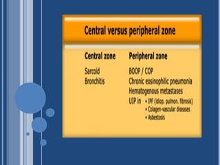 The basic interpretation of hrct