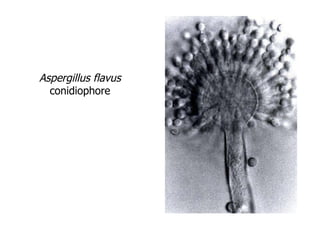 Aspergillus flavus  conidiophore 