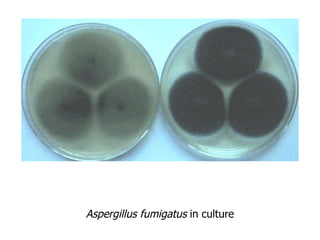 Aspergillus fumigatus  in culture 