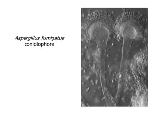 Aspergillus fumigatus  conidiophore 
