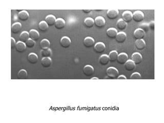 Aspergillus fumigatus  conidia 