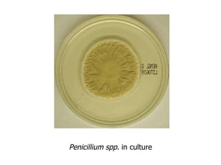 Penicillium spp.  in culture 