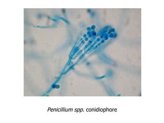 Penicillium spp.  conidiophore 