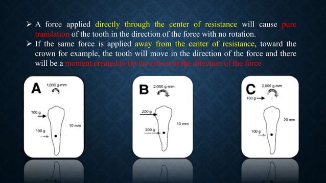 The basics of Orthodontic Mechanics | PPTX | Dental Health | Diseases ...