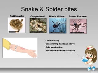 Snake & Spider bites
Rattlesnake Copperhead Black Widow Brown Recluse
•Limit activity
•Constricting bandage above
•Cold application
•Advanced medical attention
 