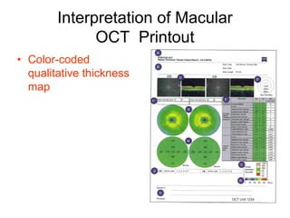 Oct Color Map The basics of retinal oct ophso.net