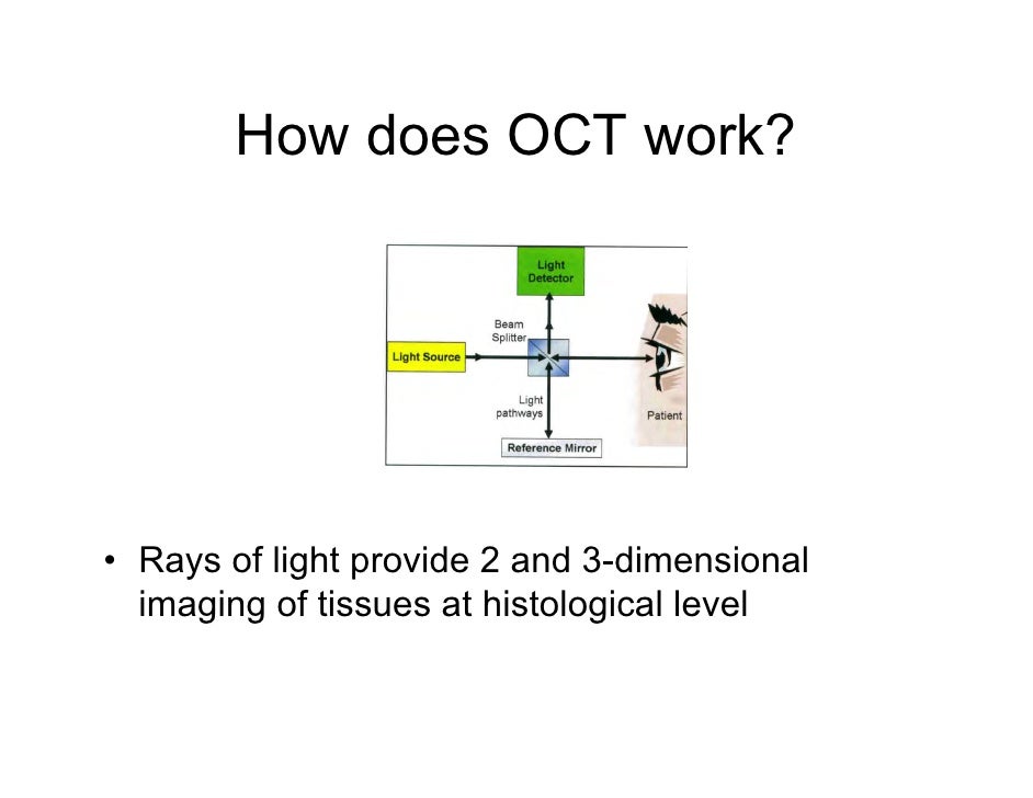 the basics of retinal oct ophso net how oct works
