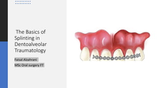 The Basics of
Splinting in
Dentoalveolar
Traumatology
Faisal Alzahrani
MSc Oral surgery FT
 