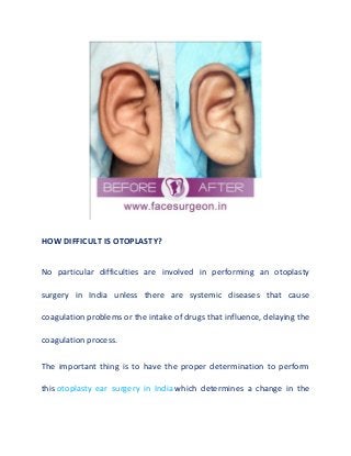 HOW DIFFICULT IS OTOPLASTY?
No particular difficulties are involved in performing an otoplasty
surgery in India unless there are systemic diseases that cause
coagulation problems or the intake of drugs that influence, delaying the
coagulation process.
The important thing is to have the proper determination to perform
this otoplasty ear surgery in India which determines a change in the
 