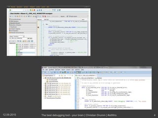 12.09.2015 The best debugging tool - your brain | Christian Drumm | #sitWro 4
 
