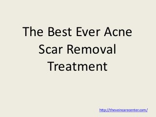 The Best Ever Acne
Scar Removal
Treatment
http://theveincarecenter.com/
 