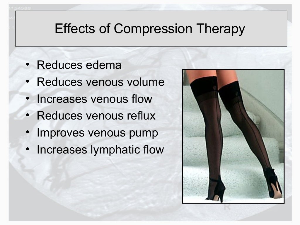The best medical treatment of venous insufficiency in 2013
