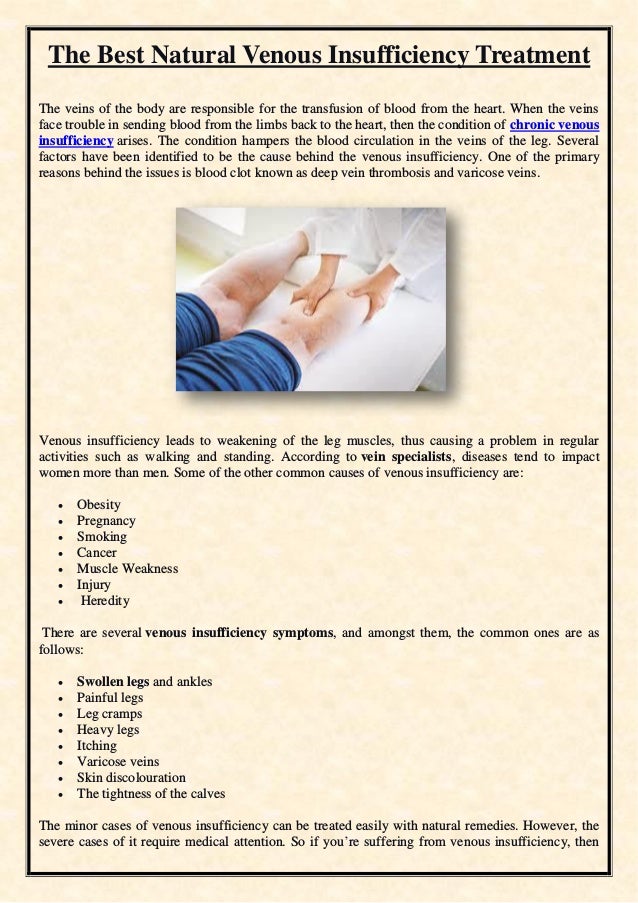 The best natural venous insufficiency treatment